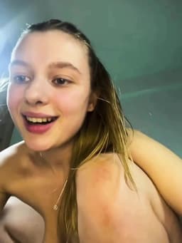 Close Anal